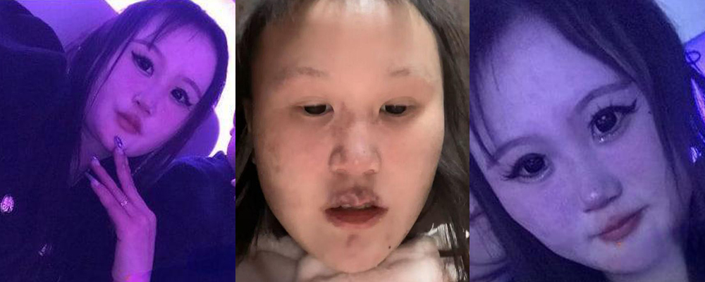 成都惊现生化母体 00后学生妹吴思婷隐瞒性病疯狂约炮  恶意传播病毒报复社会